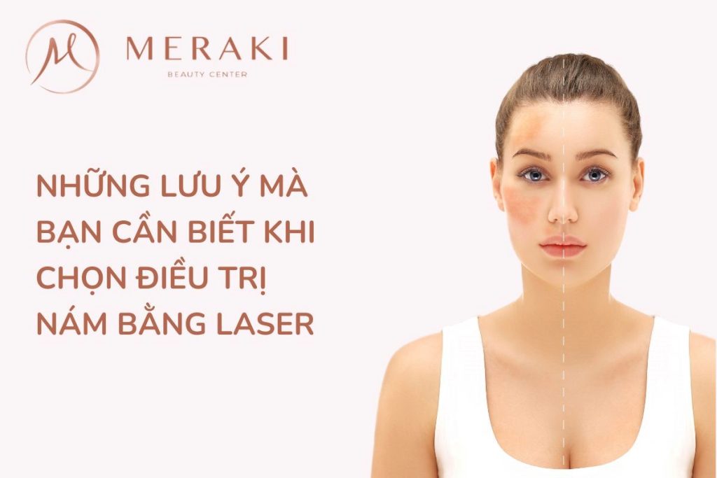 lưu ý mà bạn cần biết khi chọn điều trị nám bằng Laser