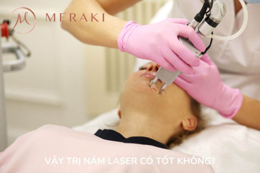 Vậy trị nám bằng tia Laser có tốt không ?