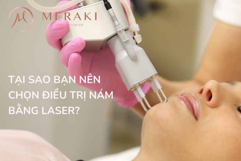 Tại sao bạn nên chọn điều trị nám bằng laser ?